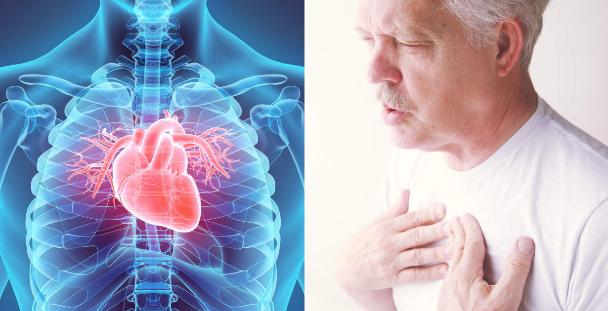 Myocarditis myocarditis pericarditis betændelse ved hjertet vaccinebivirkninger vaccineskader pfizer moderna akupunktur hjælp københavn østerbro